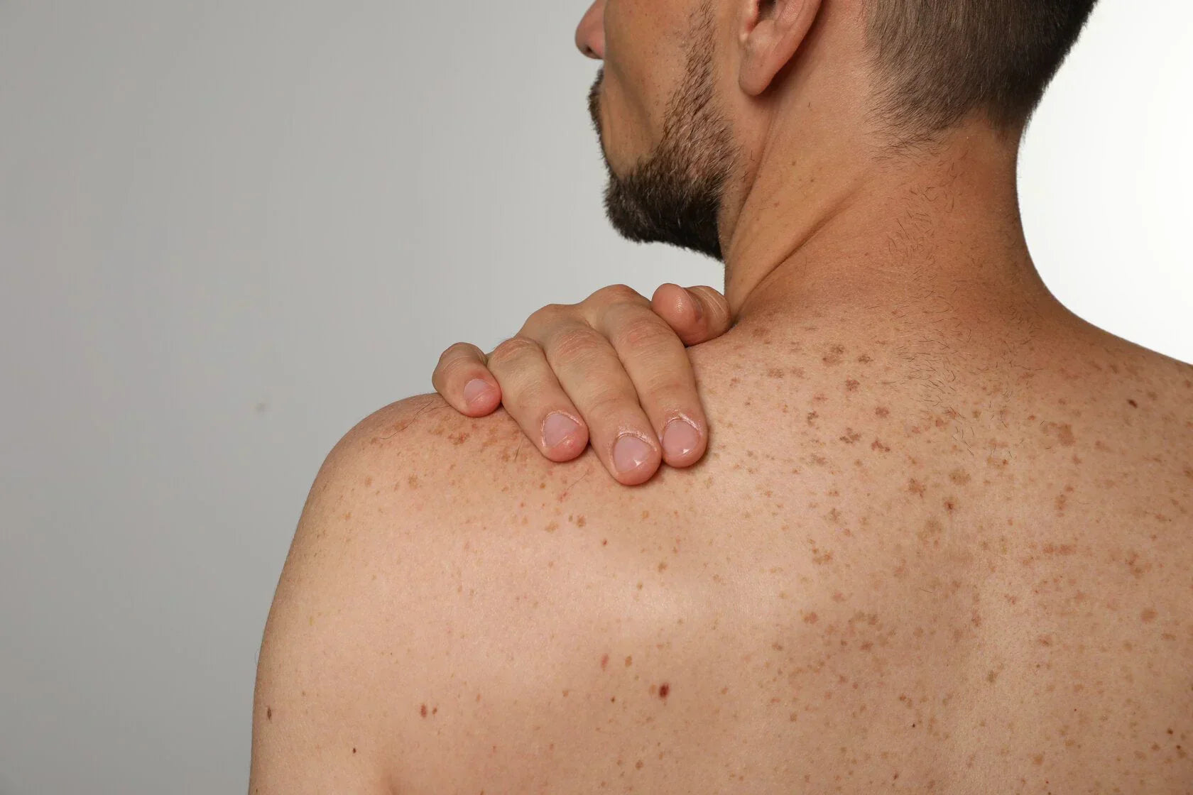 Unraveling Skin Cancer and Embracing Nature's Defenses